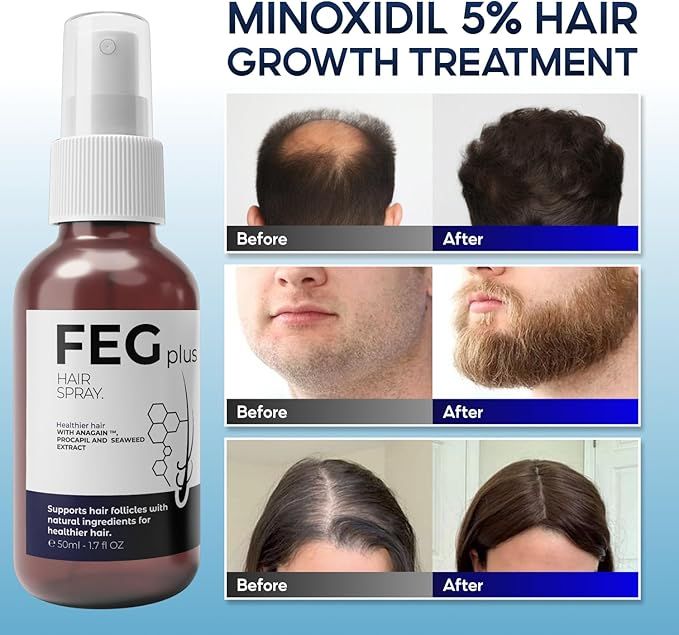 FEG Hair Regrowth Spray Boost Hair Volume & Stop Hair Loss